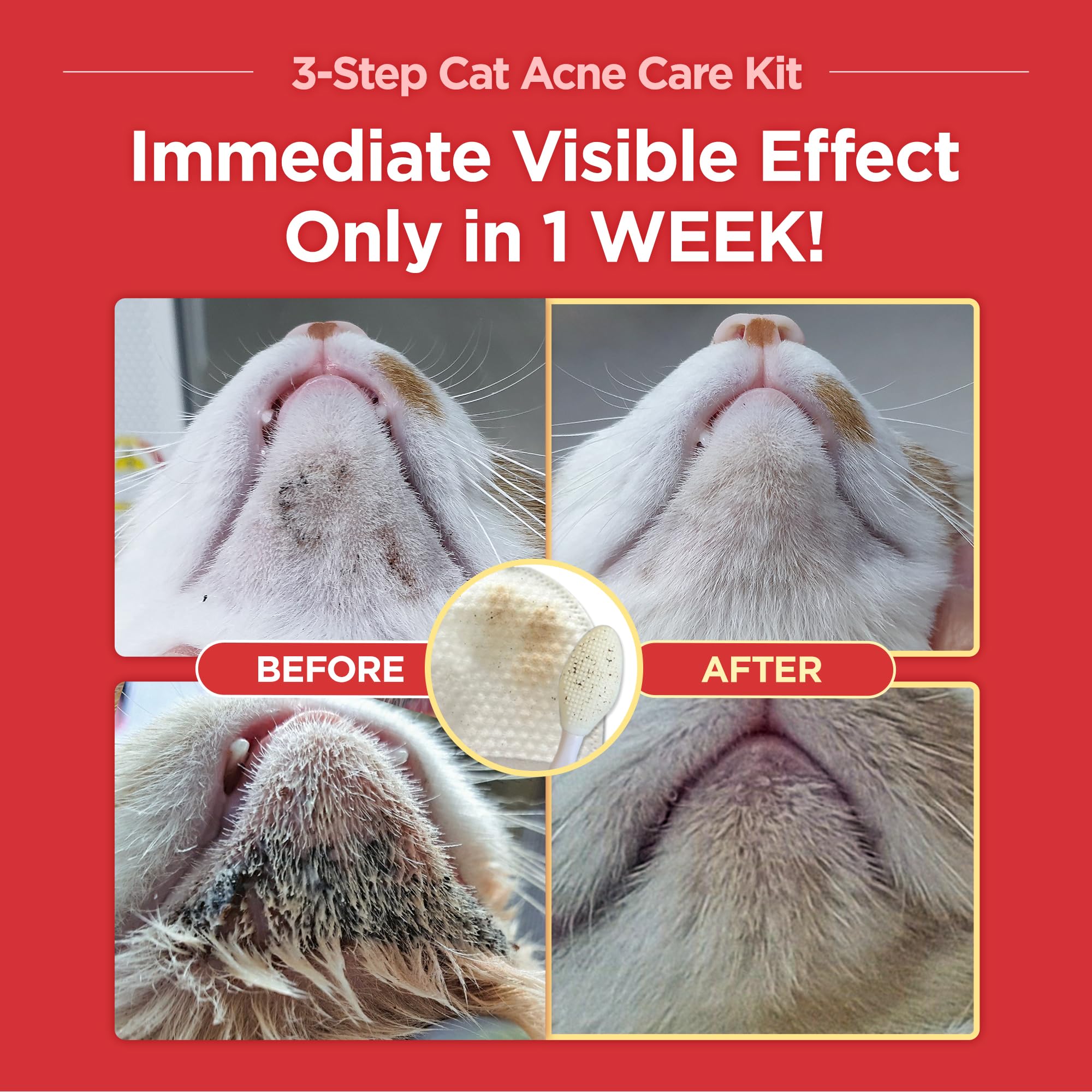 مجموعة العناية بحب الشباب للقطط من 3 خطوات جايو بيت - منظف لا يسبب الحساسية لحب والقطط السوداء 1EA وسادات مزدوجة الجوانب مناديل مبللة 30 قطعة فرشاة سيليكون ناعمة للعناية